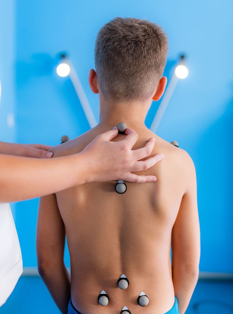 11.-Relationship-between-nutrition-and-postural-status